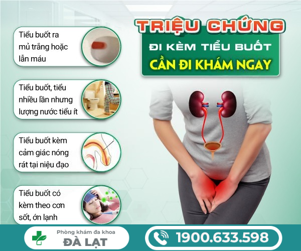 Hình ảnh minh họa